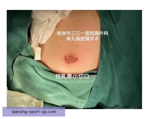 坎宁安气胸康复持续推进 活塞计划一周后复查评估